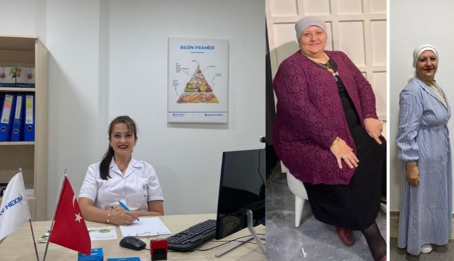  - Lokman Hekim Akay Hastanesi'nde 1 yılda 35 Kilo Verdi